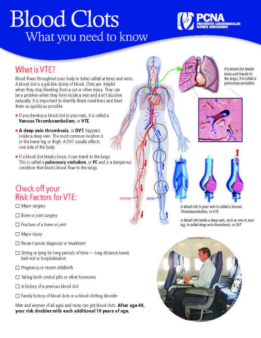 Blood Clots in Veins, Heart and Lungs > Fact Sheets > Yale Medicine