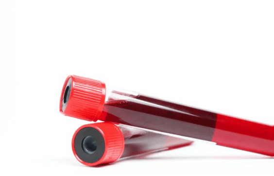 Blood Test